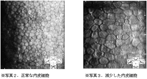 角膜内皮細胞の写真